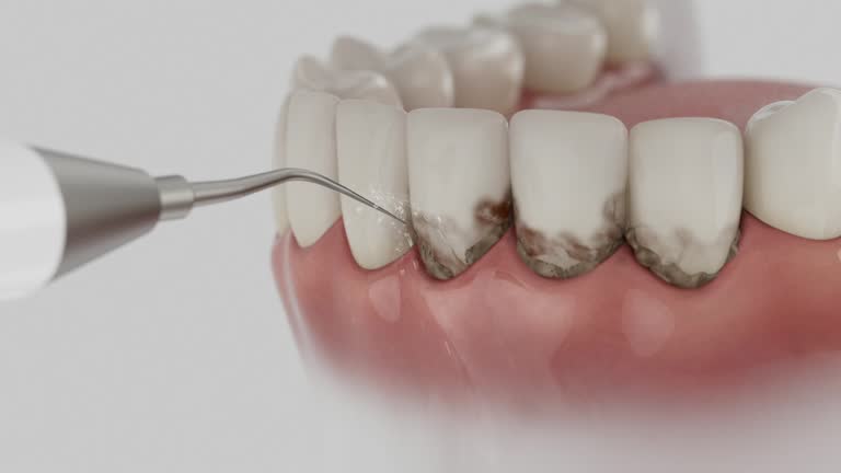 Trusted Wisdom Tooth Removal service in Pottsboro, TX - Dentist Open Now